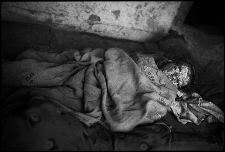 Survivor of a US airstrike.   Kunar, Afghanistan 2007.